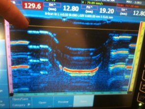 Voids in doubler reinforcement